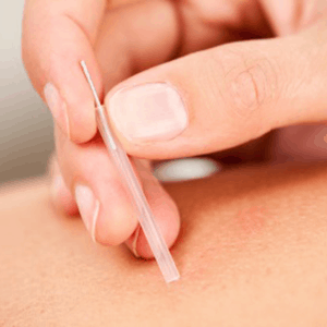 Marianka-van-Hemert-Dry-needling